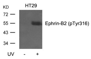 EFNB2 Antibody