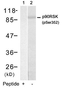 RPS6KA1 Antibody