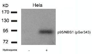 p95 / NBS1 (phospho Ser343) Antibody