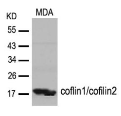 CFL1 CFL2 Antibody