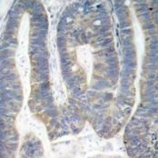 PKR (Ab 451) Antibody