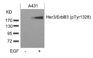 ERBB3 Antibody