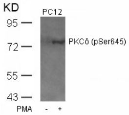 PRKCD Antibody