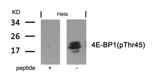 EIF4EBP1 Antibody
