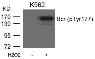 BCR Antibody