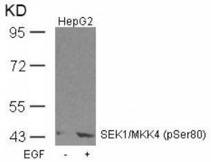 SEK1 / MKK4 (phospho Ser80) Antibody