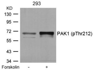 PAK1 (phospho Thr212) Antibody