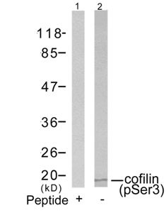 CFL1 Antibody