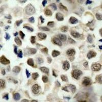 HDAC8 (phospho Ser39) Antibody