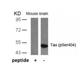 Tau (phospho Ser404) Antibody