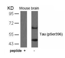 Tau (phospho Ser396) Antibody
