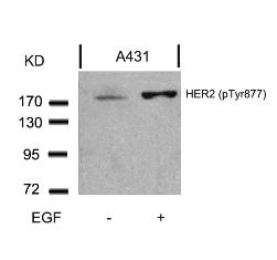 HER2 (phospho Tyr877) Antibody