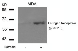 ESR1 Antibody