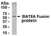 ST8SIA1 Antibody