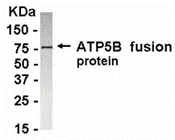 ATP5B Antibody