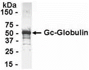 GC Antibody