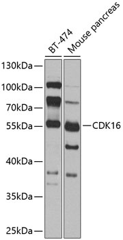 CDK16 Antibody