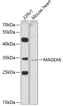 MAGEA6 Antibody