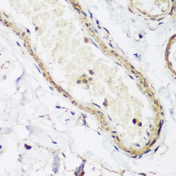 CAV3 Antibody