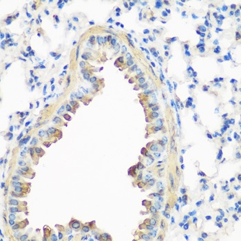 CAV3 Antibody
