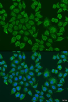 BLOC1S2 Antibody