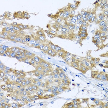 COQ7 Antibody