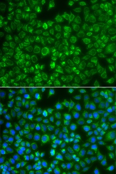 MTMR4 Antibody