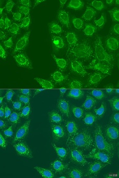 HSD17B3 Antibody