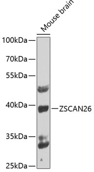 ZSCAN26 Antibody