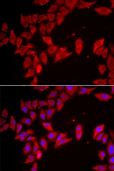 SLC35A2 Antibody