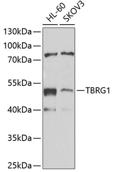 TBRG1 Antibody
