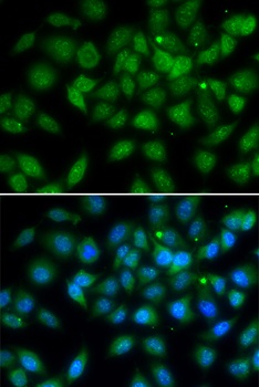 LELP1 Antibody