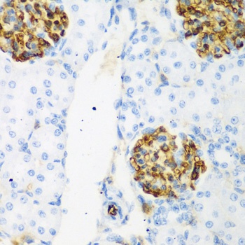 CSRNP1 Antibody