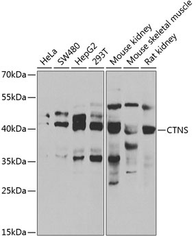 CTNS Antibody