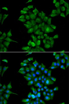 CTNS Antibody