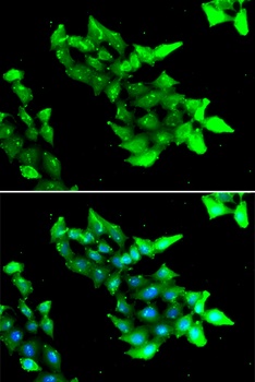 KRIT1 Antibody