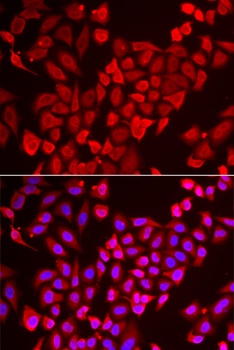 TNP2 Antibody