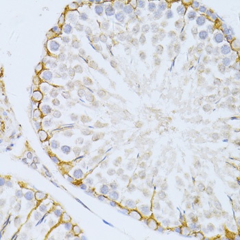 PIKFYVE Antibody