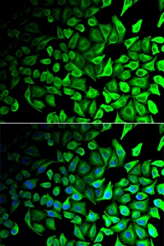 DPP7 Antibody