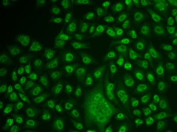 TFPT Antibody