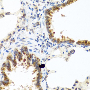 C8orf4 Antibody