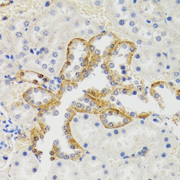 SH2B1 Antibody