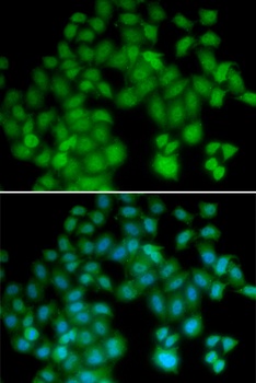 TMSB4X Antibody