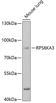 RPS6KA3 Antibody