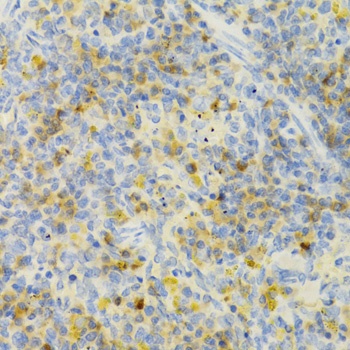 PAK1 Antibody