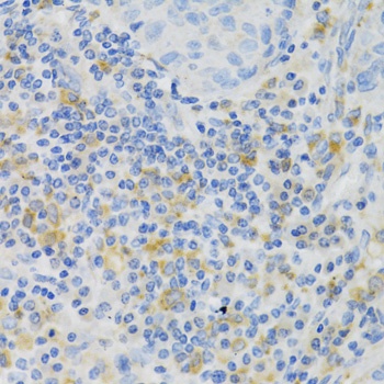 PAK1 Antibody