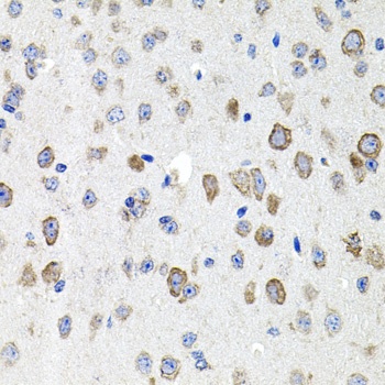 CDH23 Antibody