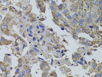GNA15 Antibody