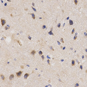 PPP2R4 Antibody