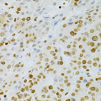 DKC1 Antibody